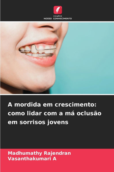 A mordida em crescimento: como lidar com a m� oclus�o em sorrisos jovens