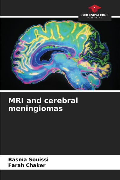 MRI and cerebral meningiomas