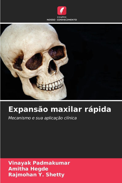 ExpansÃ¯Â¿Â½o maxilar rÃ¯Â¿Â½pida