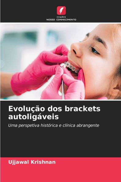EvoluÃ¯Â¿Â½Ã¯Â¿Â½o dos brackets autoligÃ¯Â¿Â½veis