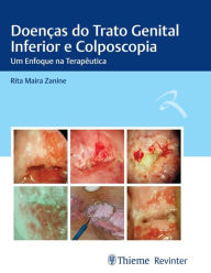 Title: Doenças do Trato Genital Inferior e Colposcopia: Um Enfoque na Terapêutica, Author: Rita Maira Zanine