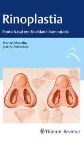 Title: Rinoplastia: Ponta Nasal em Realidade Aumentada, Author: Marcos Mocellin