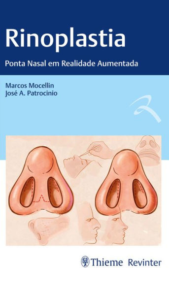 Rinoplastia: Ponta Nasal em Realidade Aumentada