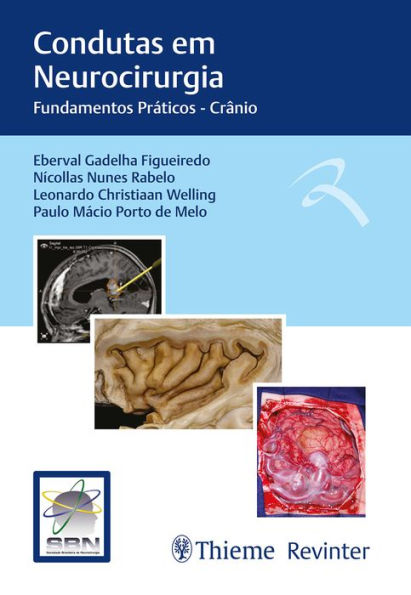 Condutas em Neurocirurgia: Fundamentos Práticos - Crânio