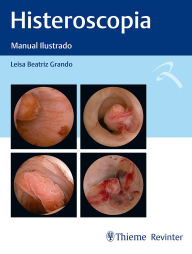 Title: Histeroscopia: Manual Ilustrado, Author: Leisa Beatriz Grando