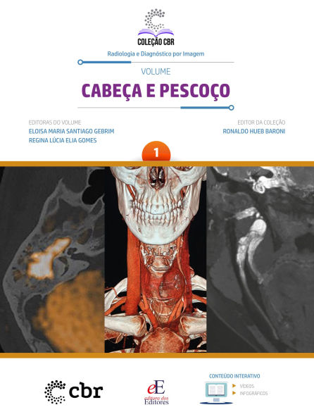 Cabeça e Pescoço - Volume 1: Coleção CBR - Radiologia e Diagnóstico por Imagem