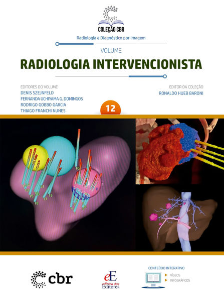 Coleção CBR Volume 12 - Radiologia Intervencionista