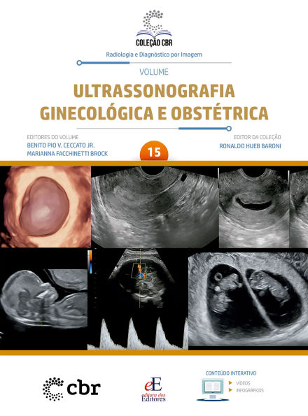 Coleção CBR Volume 15 - Ultrassonografia Ginecológica e Obstétrica