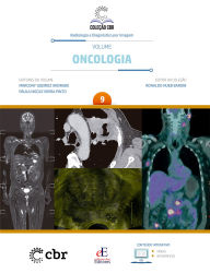 Title: Volume 9 - Oncologia, Author: MARCONY QUEIROZ ANDRADE