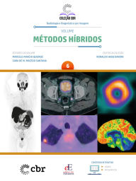 Title: Volume 6 - Métodos Híbridos, Author: MARCELO ARAÚJO QUEIROZ