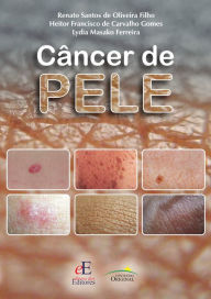 Title: Câncer de pele, Author: Renato Santos de Oliveira Filho