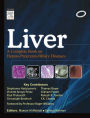 Liver: A Complete Book on Hepato-Pancreato-Biliary Diseases - E-Book