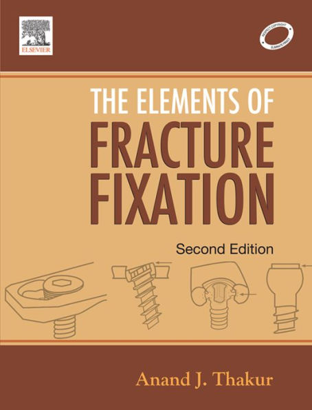 Elements of Fracture Fixation - E-Book