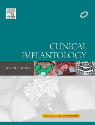 Title: Clinical Implantology, Author: Ajay Vikram Singh