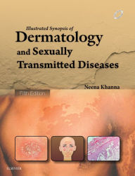 Title: Illustrated Synopsis of Dermatology & Sexually Transmitted Diseases - E-book, Author: Neena Khanna