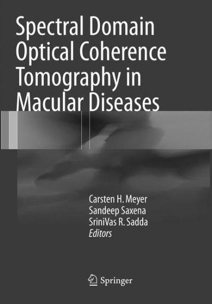 Spectral Domain Optical Coherence Tomography in Macular Diseases