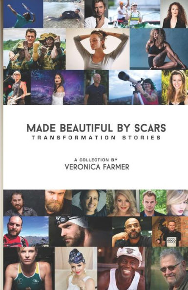 Made Beautiful by Scars: Transformation Stories