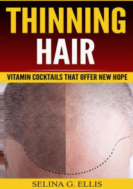 Title: Thinning Hair: Vitamin Cocktails That Offer New Hope, Author: Selina G Ellis