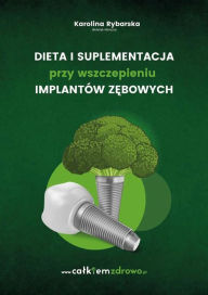 Title: Dieta i suplementacja przy wszczepieniu implantów zebowych, Author: Karolina Rybarska