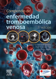 Title: Compendio de enfermedad tromboembólica venosa, Author: Sonia del Pilar Otálora Valderrama