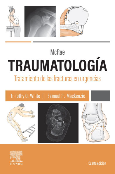 McRae. Traumatología. Tratamiento de las fracturas en urgencias