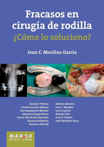 Fracasos en cirugï¿½a de rodilla ï¿½Cï¿½mo lo soluciono?