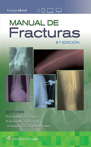 Manual de fracturas / Edition 6