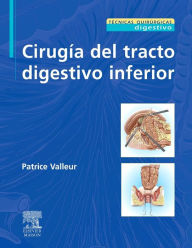 Title: Cirugía del tracto digestivo inferior, Author: Patrice Valleur