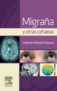 Title: Migraña y otras cefaleas, Author: Valentín Mateos Marcos