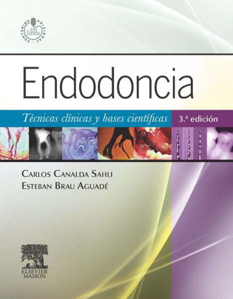 Endodoncia + StudentConsult en español: Técnicas clínicas y bases científicas