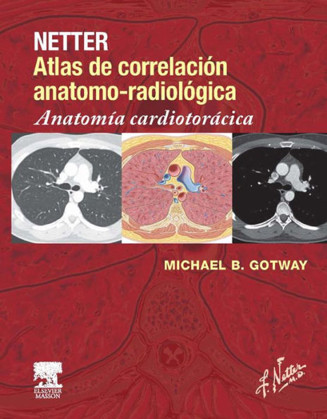 Netter. Atlas de correlación anatomo-radiológica: Anatomía cardiotorácica