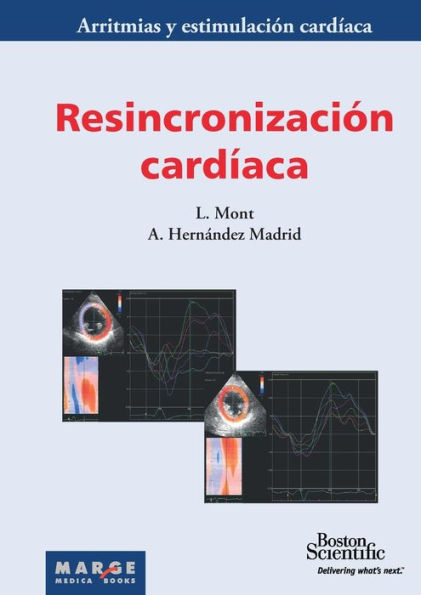 Resincronizaciï¿½n cardï¿½aca