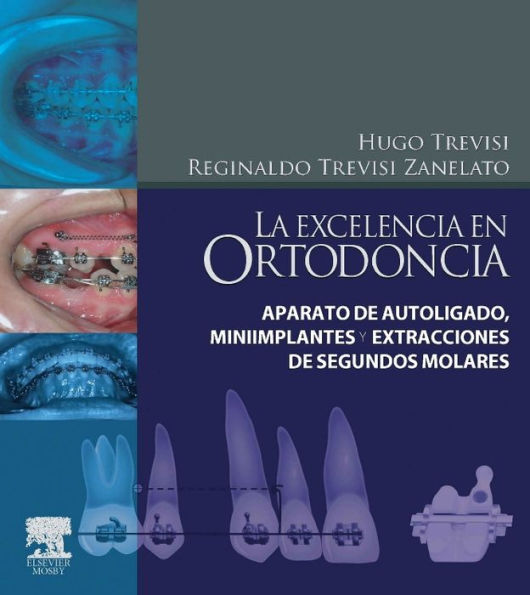 La excelencia en ortodoncia: Aparato de autoligado, miniimplantes y extracciones de segundos molares