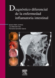 Title: Diagnóstico diferencial de la enfermedad inflamatoria intestinal, Author: Ignacio Marín-Jiménez