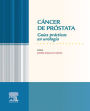 Cáncer de próstata: Guías prácticas en urología