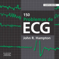 Title: 150 problemas de ECG, Author: John R. Hampton