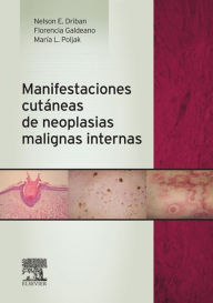 Title: Manifestaciones cutáneas de neoplasias malignas internas, Author: Nelson Edgardo Driban