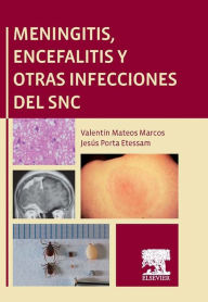 Title: Meningitis, encefalitis y otras infecciones del SNC, Author: Valentín Mateos Marcos