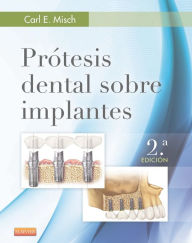 Title: Prótesis dental sobre implantes, Author: Carl E. Misch DDS