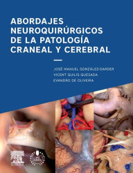 Title: Abordajes neuroquirúrgicos de la patología craneal y cerebral + acceso web, Author: José Manuel González Darder