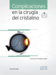 Title: Complicaciones en la cirugía del cristalino: Monografías SECOIR, Author: Francisco Poyales Galán