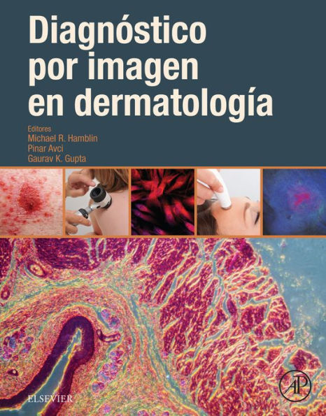 Diagnóstico por imagen en dermatología