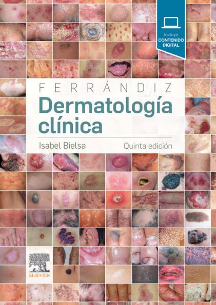 Ferrándiz. Dermatología clínica