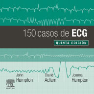 Title: 150 casos de ECG, Author: John Hampton DM