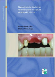 Title: Reconstrucción de dientes endodonciados: Pautas de actuación clínica, Author: Ernest Mallat Callís