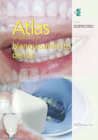 Title: Atlas terapéutico de blanqueamiento dental, Author: José Amengual Lorenzo