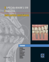 Title: Especialidades em Imagens: Implantes Dentarios, Author: Drew's Famous