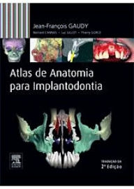 Title: Atlas de Anatomia para Implantodontia, Author: Jean-François GAUDY