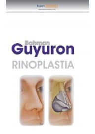 Title: Rinoplastia, Author: Bahman Guyuron