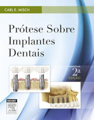 Title: Prótese sobre Implantes Dentais, Author: Carl E. Misch